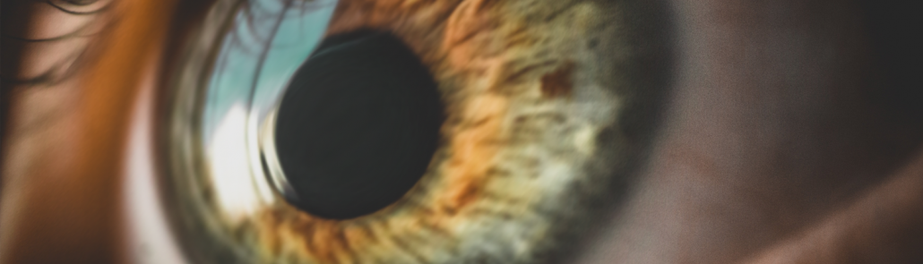 Recognizing the Signs of Keratoconus - VIP Laser Eye Center